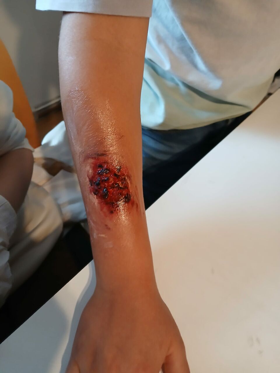 Geschminkte Wunde am Unterarm